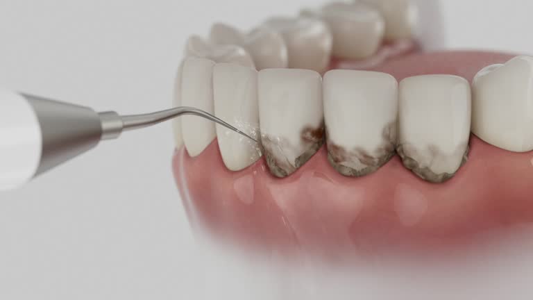 Trusted Emergency Dentist service in Culloden, WV - Dentist Open Now
